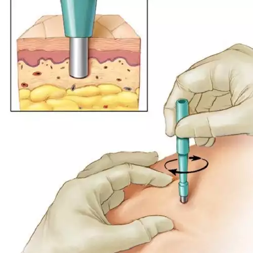Артикул 14017-1